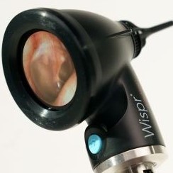 MS450D39 Digital Otoscope with Screen: Best Otoscope for Home Use