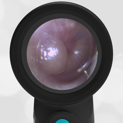 4-year-old with Ear Pain