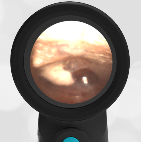 5-year-old with a Cough