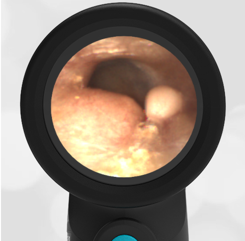 50-year-old Scuba Diver