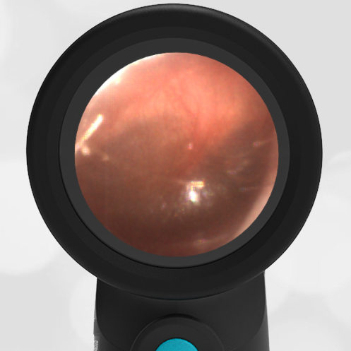 4-year-old with a Cough