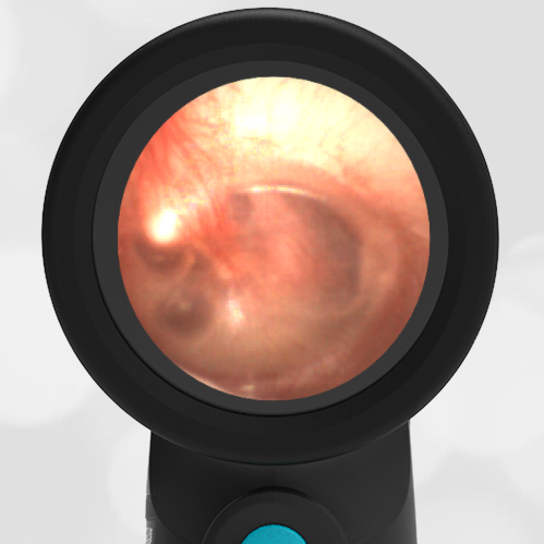 7-year-old with Ear Pain