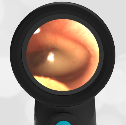 Young Child with Mild Ear Pain: Part 1