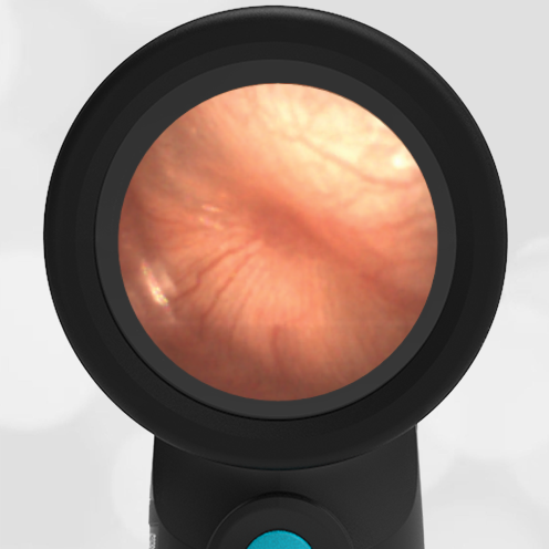 Six-year-old with Ear Pain