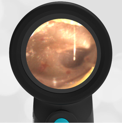 14-month-old with Fever and Cough