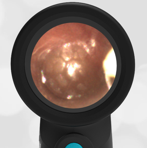 7-year-old with Right Ear Pain