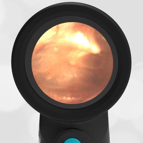 14-month-old with Ear Pain