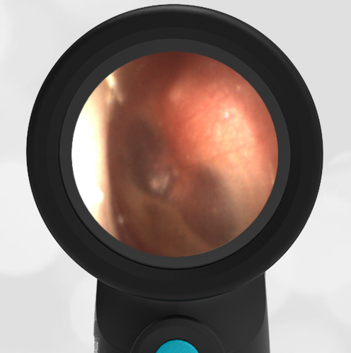 2-year-old with a Cough