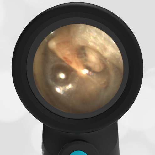 35-year-old Woman with Ear Finding