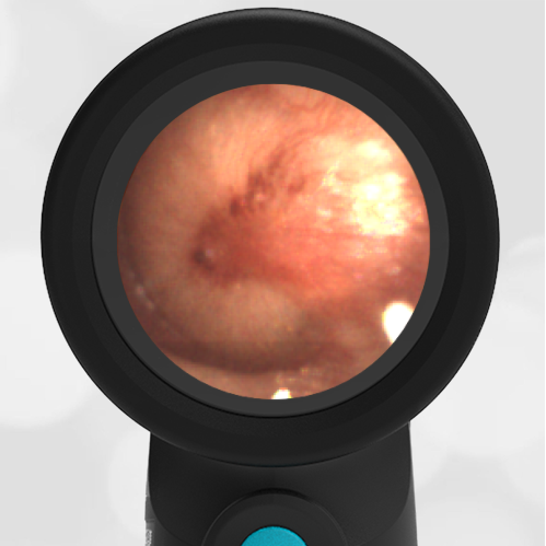 4-year-old with Ear Pain