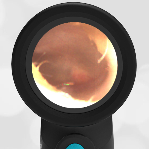 3-year-old with a Cough