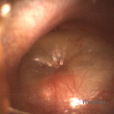 Visual Ear Diagnosis Guide