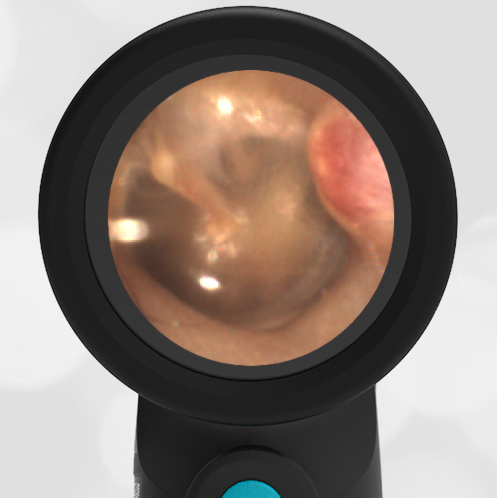 40-year-old with an Ear Lesion