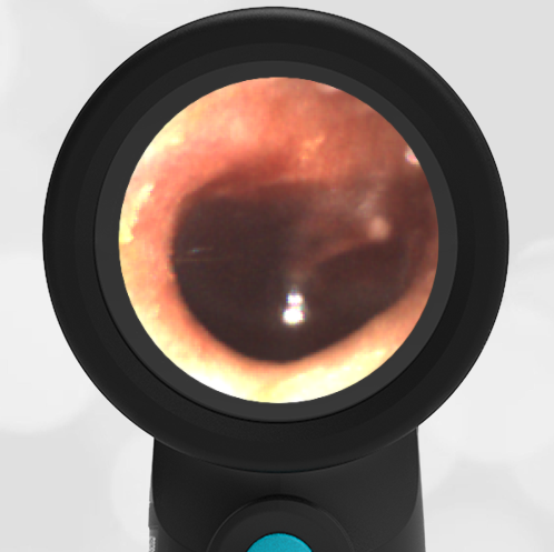 16-year-old with Head Trauma