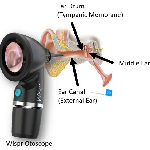 Normal Ear Anatomy