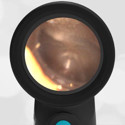 7-Month-Old with an Allergic Reaction