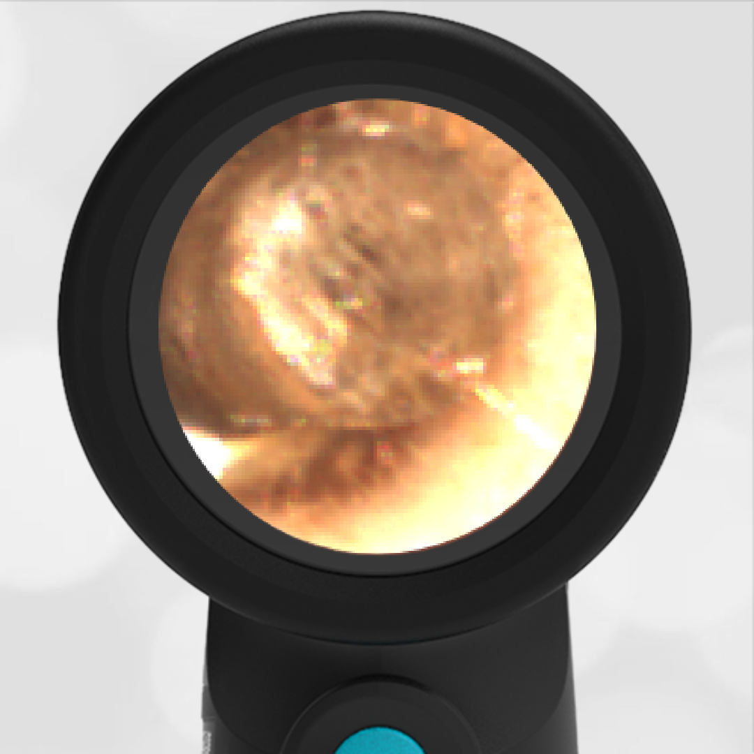 7-year-old with Ear Pain