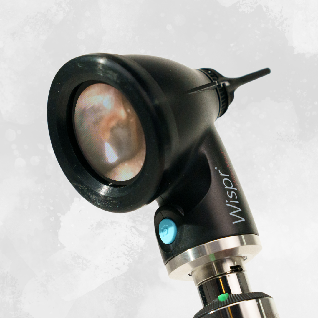 Wispr Digital Otoscope Eliminated Repeat Ear Exams in 75% of Patients in PAS Study