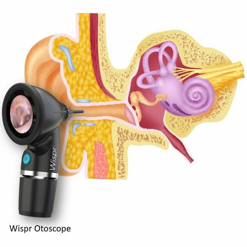 Wispr Digital Otoscope Exam Tips