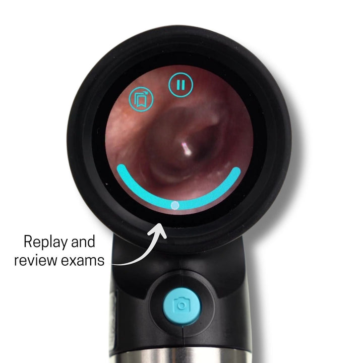 Wispr Camera Wispr Standard Bundle (4 Items) – WiscMed