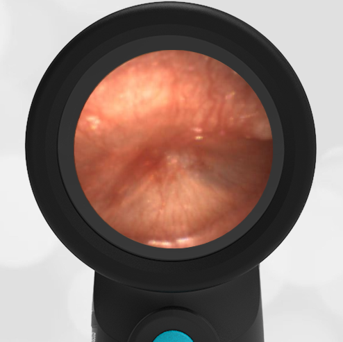 Wispr Camera The Wispr – WiscMed