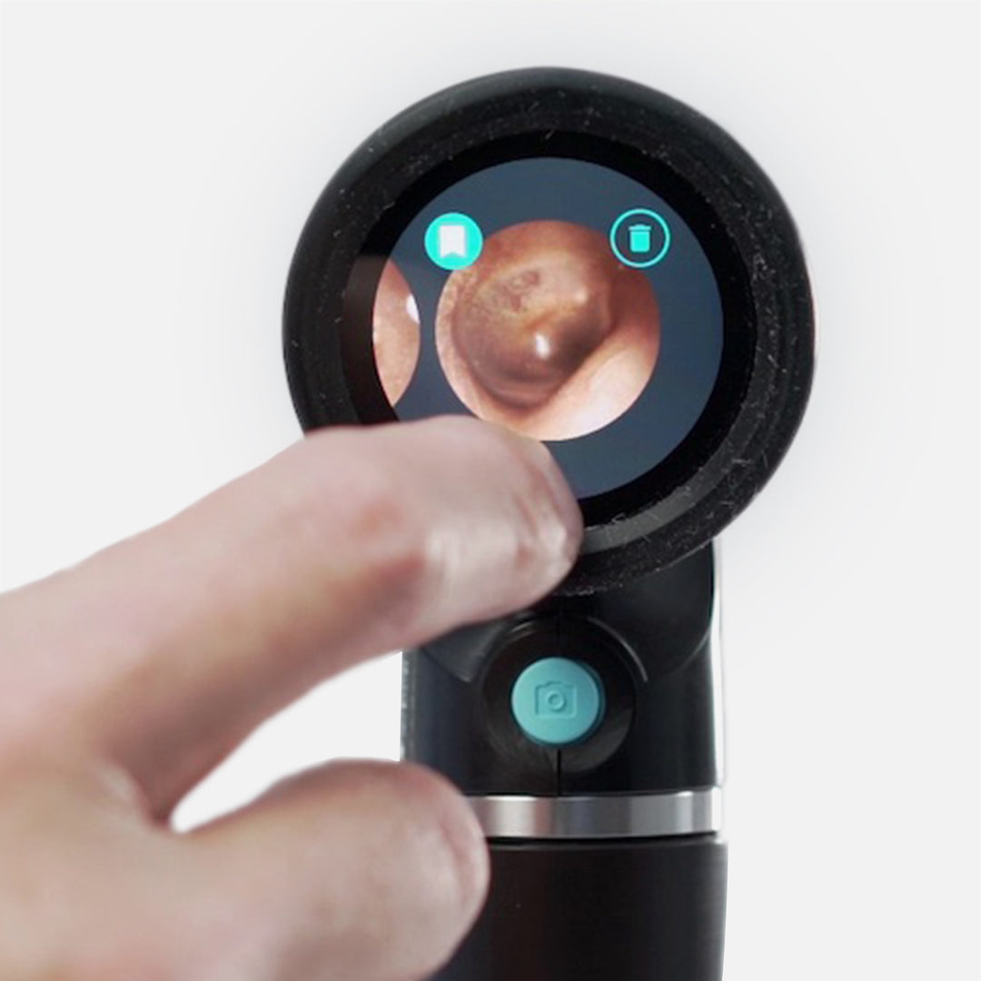 Wispr Camera Otoscope View