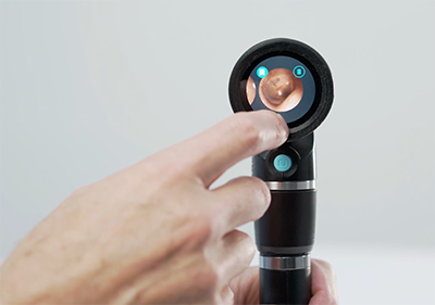 Wispr Camera The Wispr – WiscMed