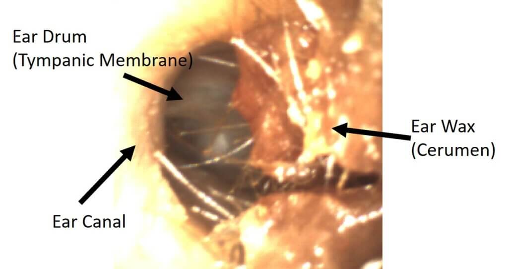 Normal Ear Anatomy WiscMed