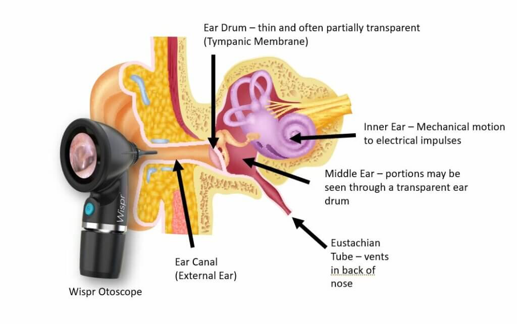 illustrated-intro-to-middle-ear-anatomy-as-seen-by-otoscopy-wiscmed